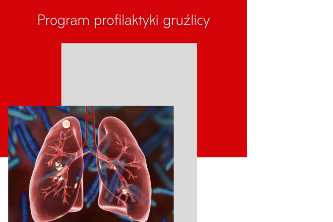 Program profilaktyki gruźlicy w Przychodniach Brackich